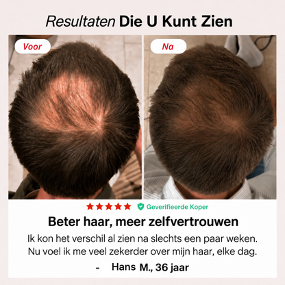 Roodlicht-Cap
