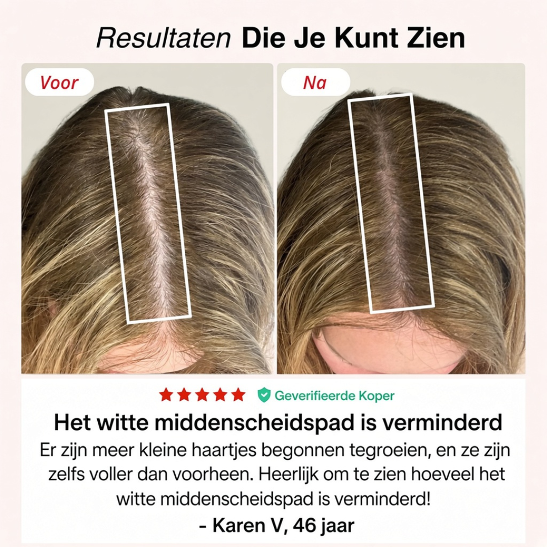 Roodlicht-Cap